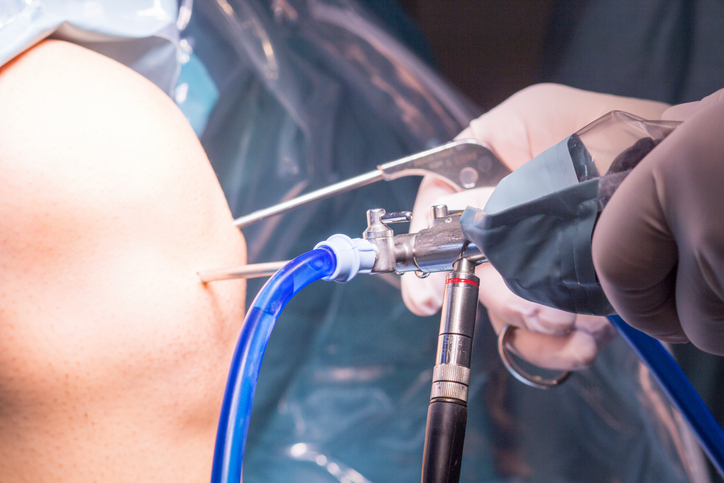 benefits arthroscopic joint replacement