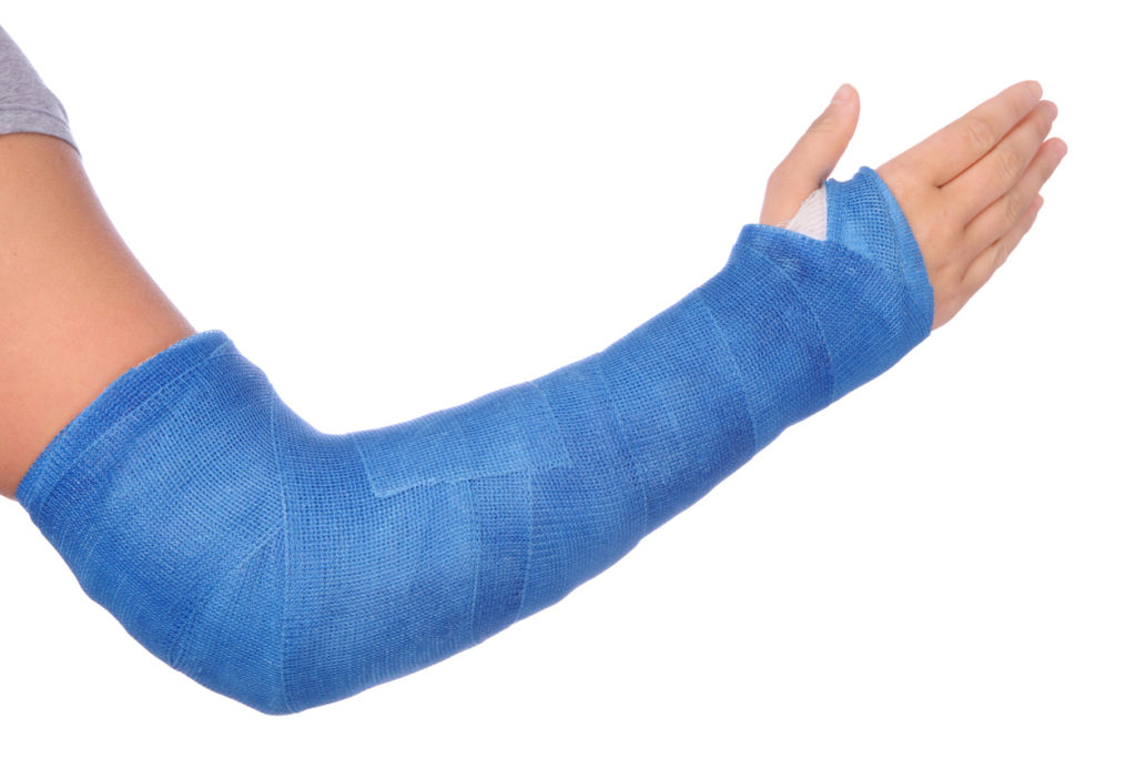 Elbow Fracture