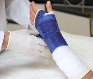 hand specialist treating a broken arm