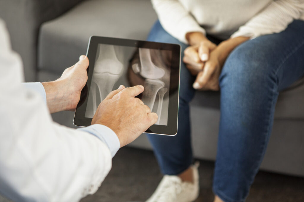 Bone Doctor explaining to senior patients the results of an examination