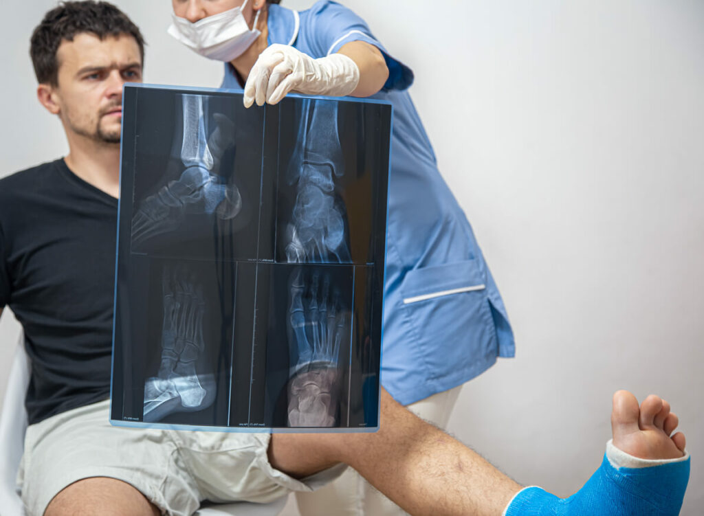 X-ray of a foot fracture close-up on a consultation with a orthopedic surgeon