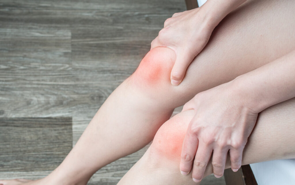 Closeup of woman hands holding and massage her knee, suffering from unstable kneecap knee pain.